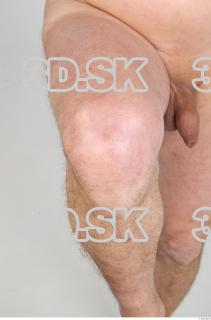 Knee texture of Gregory 0002